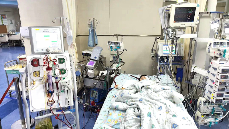 PICU里，上了ECMO+CRRT 的小依依。浙大兒院供圖
